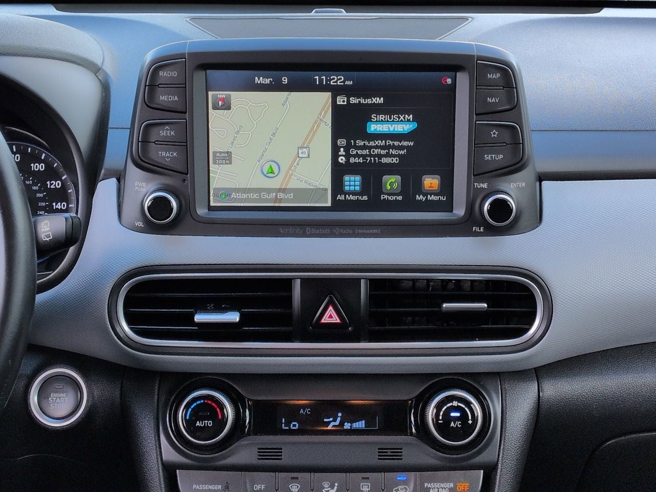 2020 Hyundai Kona Ultimate